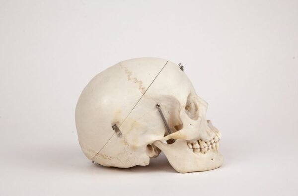 Adolescent Medical Skull (0265) - Image 2