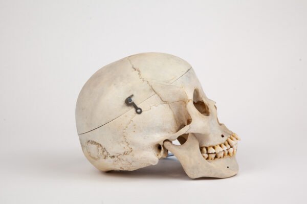 Medical Skull (0267) - Image 2