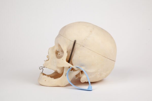 Geriatric Skull (0281)