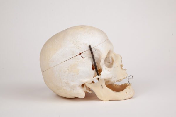 Geriatric Skull (0281) - Image 2