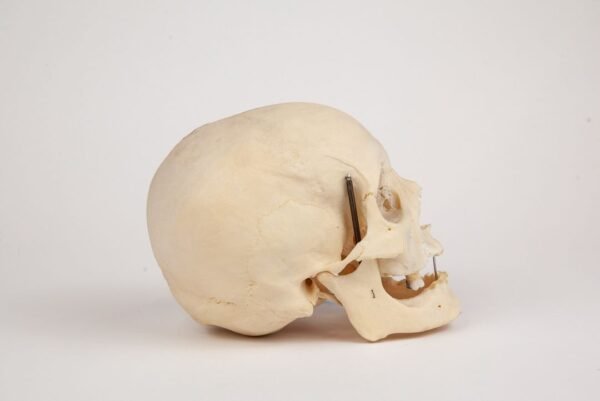 Uncut Geriatric Skull (0284) - Image 3