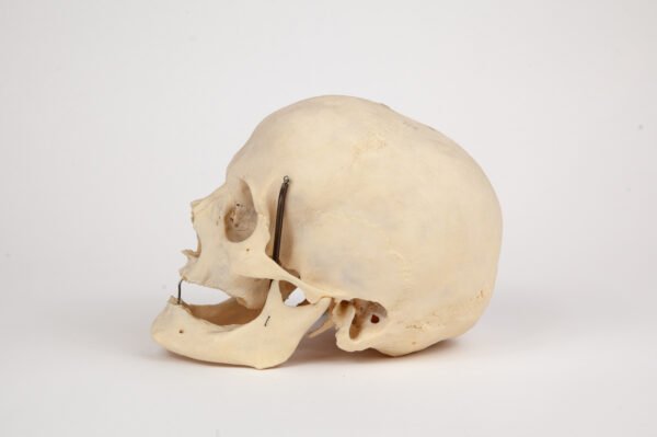 Uncut Geriatric Skull (0285) - Image 3