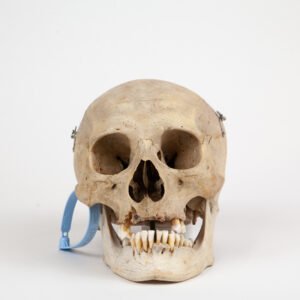 Medical Skull (0287)