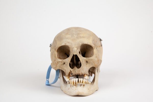 Medical Skull (0287)