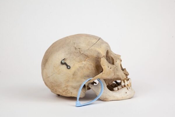 Medical Skull (0287) - Image 2