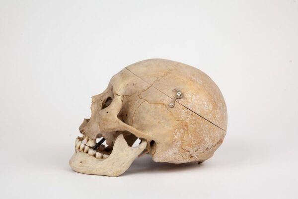 Medical Skull (0287) - Image 3