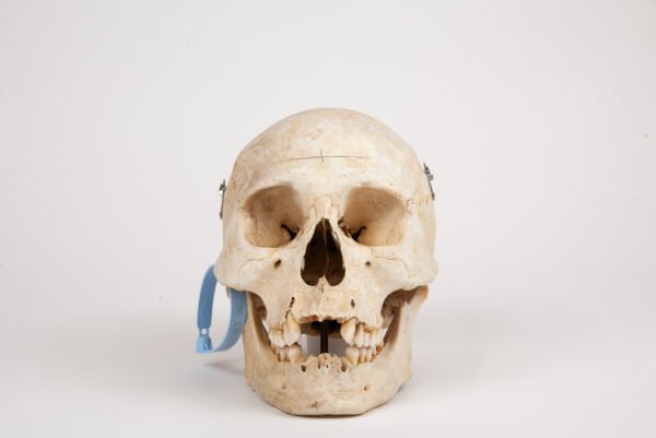 Medical Skull (0288)