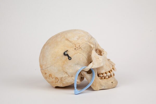 Medical Skull (0288)