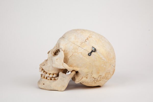 Medical Skull (0288) - Image 2