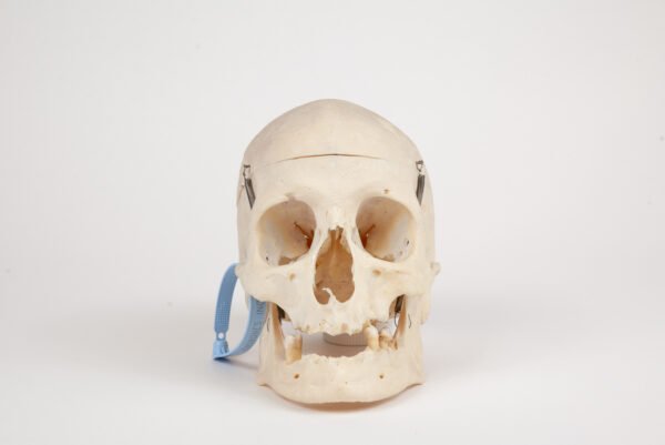 Medical Skull (0289)