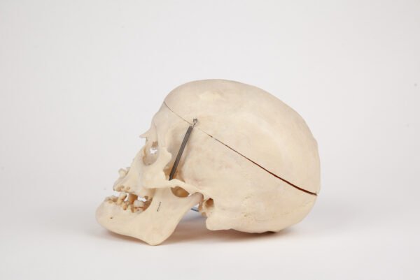 Medical Skull (0289) - Image 2