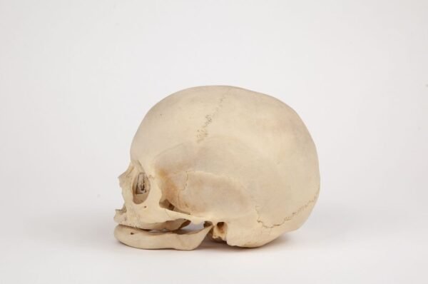 Uncut Geriatric Skull (0293) - Image 2