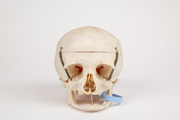 Geriatric Skull (0294)