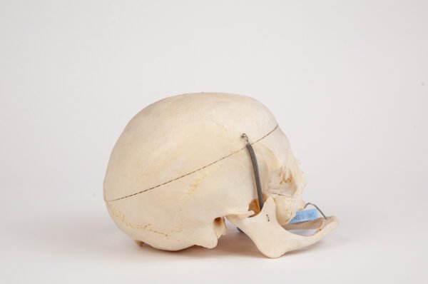 Geriatric Skull (0294) - Image 3