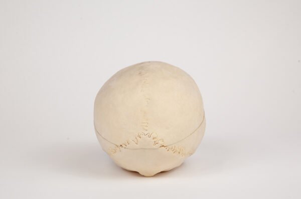 Geriatric Skull (0294) - Image 2