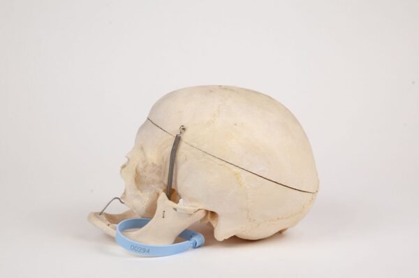 Geriatric Skull (0294) - Image 4