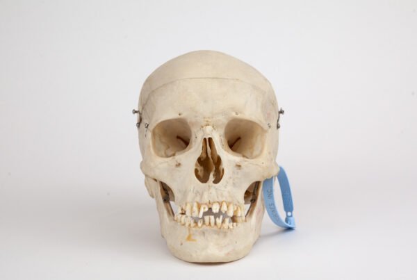 Medical Skull (0295)