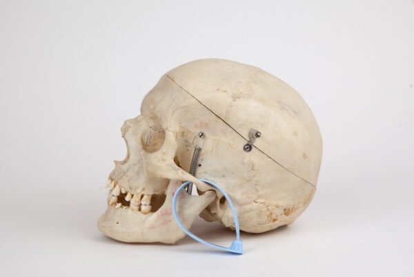 Medical Skull (0295) - Image 2