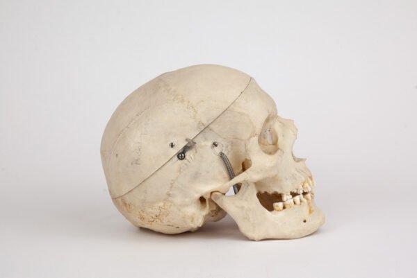 Medical Skull (0295)