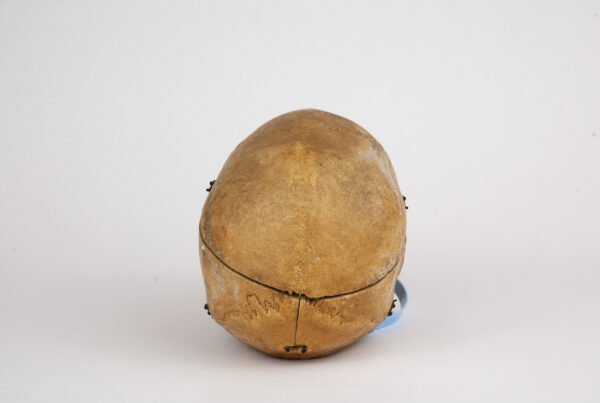 Medical Skull (0297)