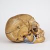 Medical Skull (0297) - Image 4