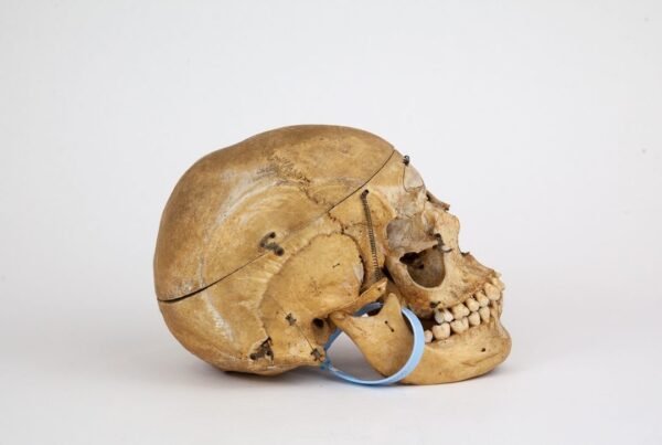 Medical Skull (0297) - Image 4