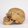 Medical Skull (0297) - Image 3