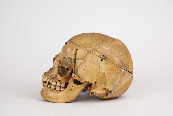 Medical Skull (0297) - Image 3