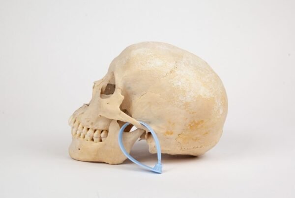 Uncut Medical Skull (0345)  - Image 3