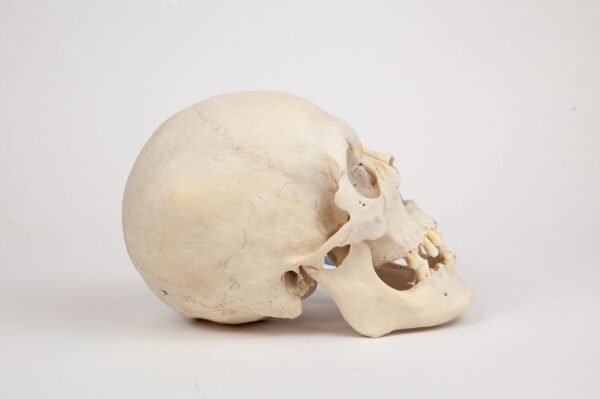 Uncut Medical Skull (0346) - Image 4