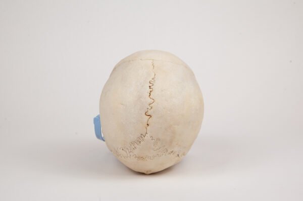 Uncut Medical Skull (0346) - Image 2