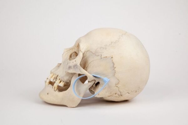Uncut Medical Skull (0346) - Image 3