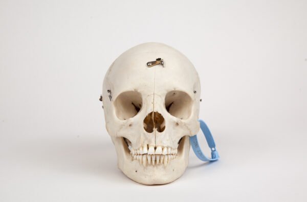 Adolescent Medical Skull (0265)