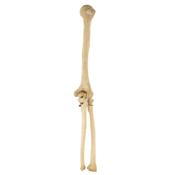 Radius, and Ulna

26137 - Image 2
