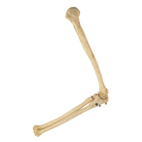 Radius, and Ulna

26137 - Image 3