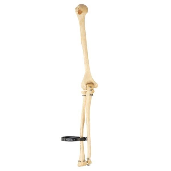 Radius, and Ulna

26124 - Image 2