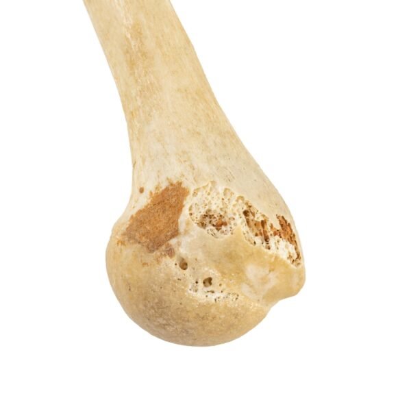 Radius, and Ulna

26124 - Image 4