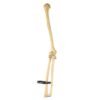 Humerus, Radius, and Ulna

26126