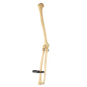 Humerus, Radius, and Ulna

26126