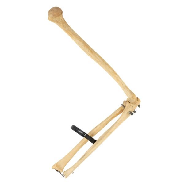 Humerus, Radius, and Ulna

26126 - Image 3