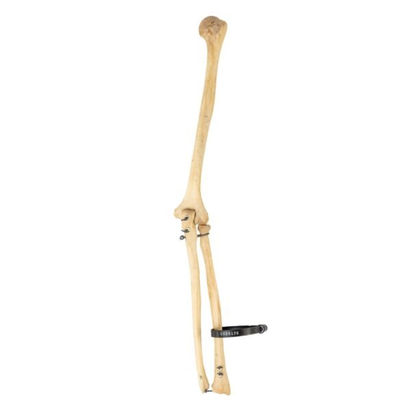Humerus, Radius, and Ulna

26126 - Image 2