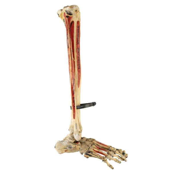 Tibia, Fibula, and Foot with Muscles
26047