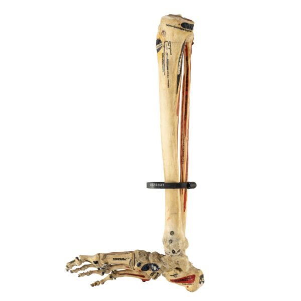 Tibia, Fibula, and Foot with Muscles
26047 - Image 2