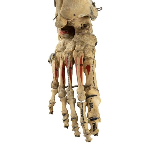 Tibia, Fibula, and Foot with Muscles
26047 - Image 3