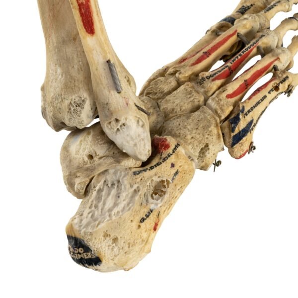 Tibia, Fibula, and Foot with Muscles
26047 - Image 4