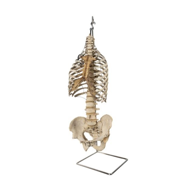 Torso and Pelvis on Stand