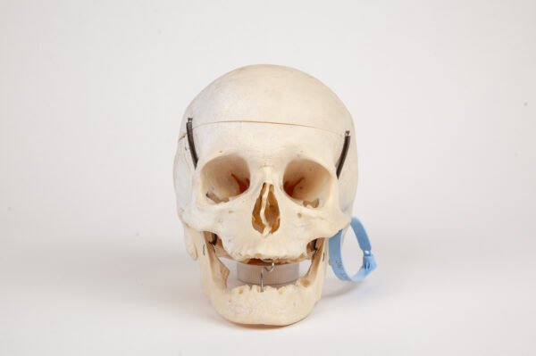 Geriatric Skull (0281)