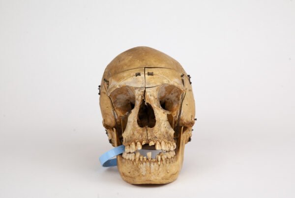 Medical Skull (0297)