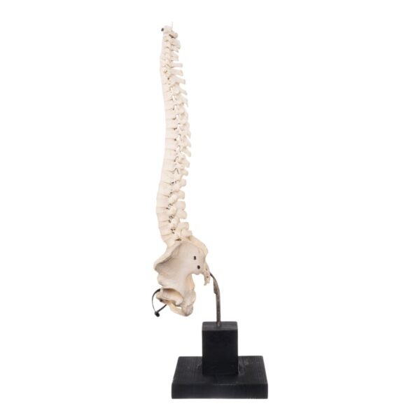 Spine and Pelvis on Stand

27995 - Image 4