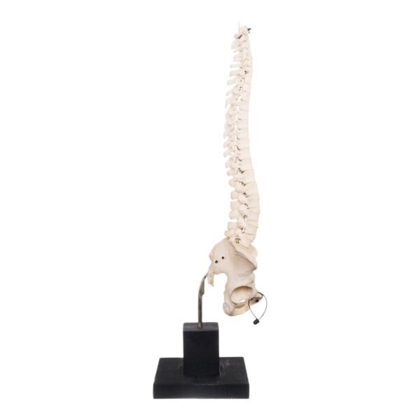 Spine and Pelvis on Stand

27995 - Image 2